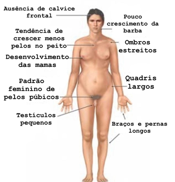 caracteristica