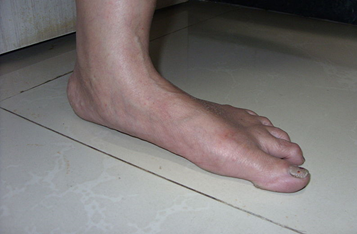 pe