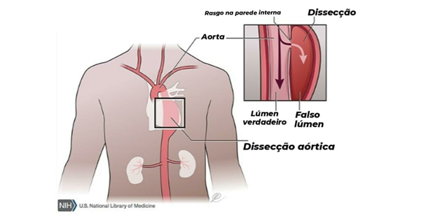 Figura4